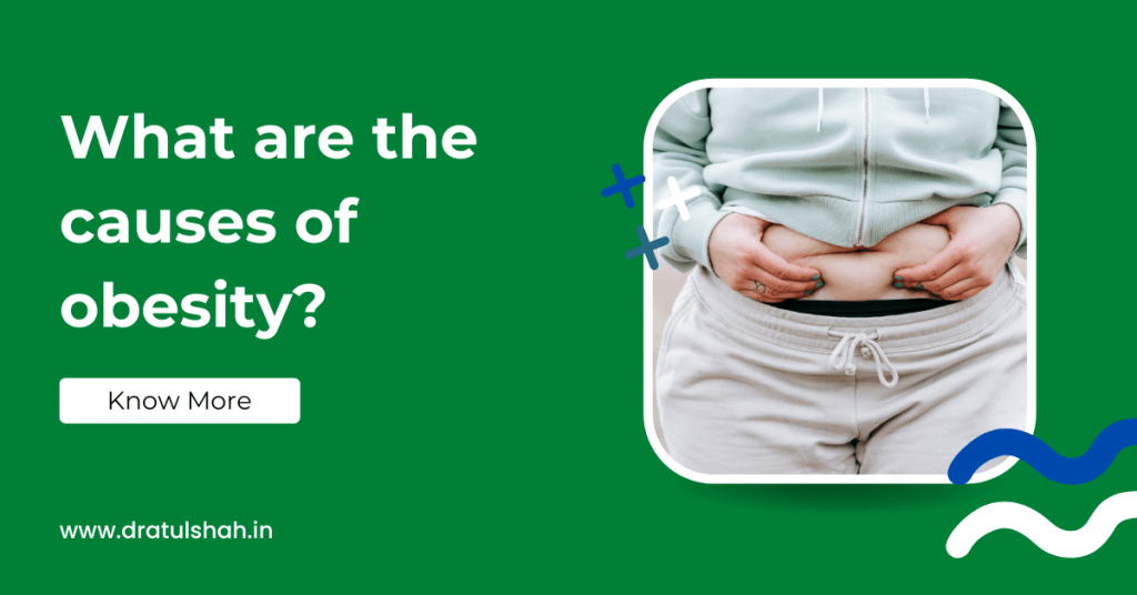 What are the causes of obesity?