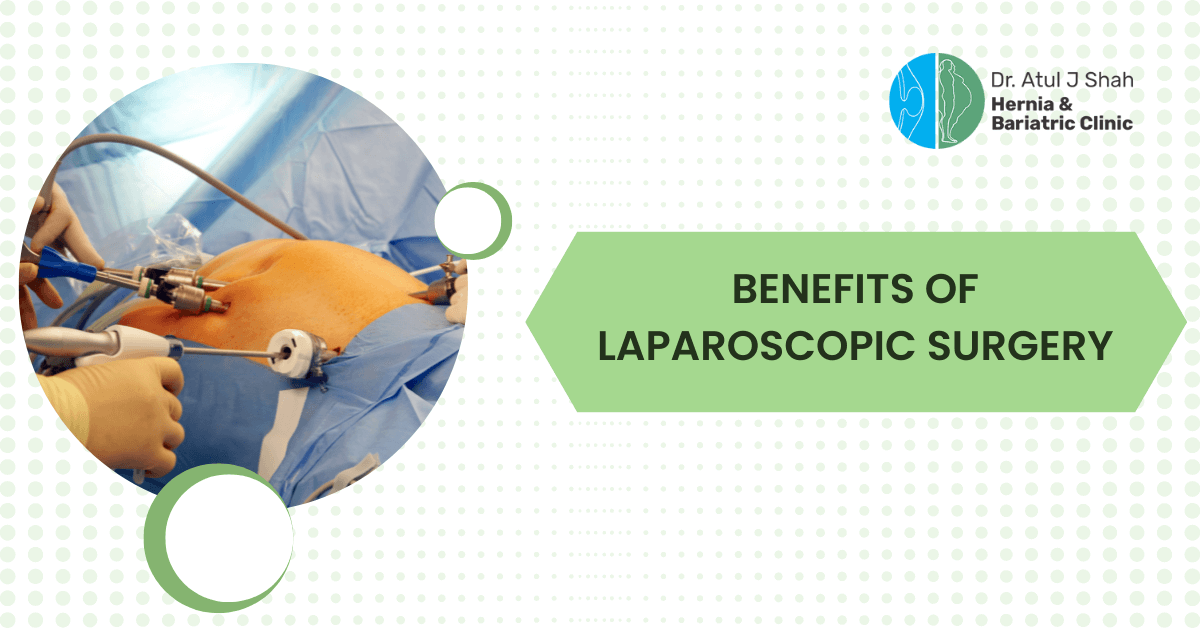 Benefits of Laparoscopic Surgery