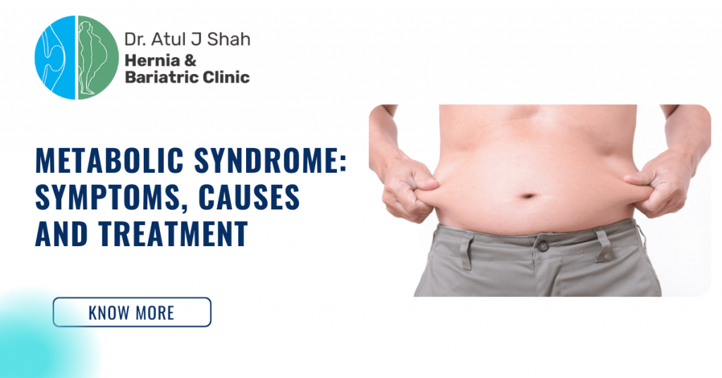 Metabolic Syndrome: Symptoms, Causes and Treatment
