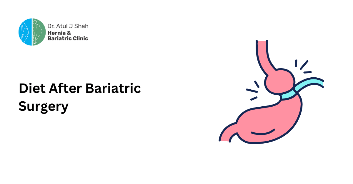 Diet After Bariatric Surgery
