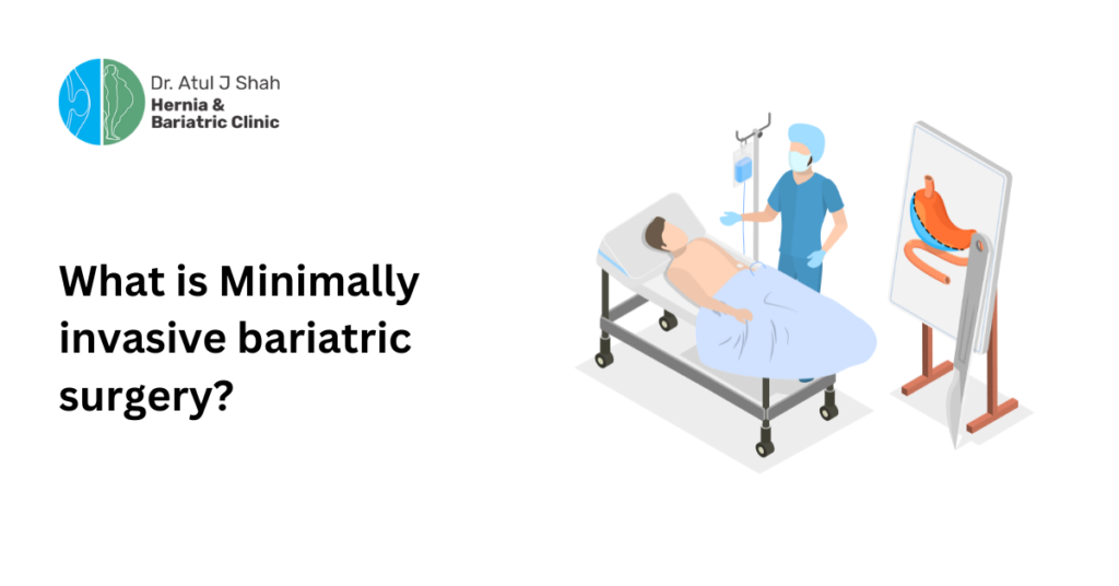 What is Minimally invasive bariatric surgery?