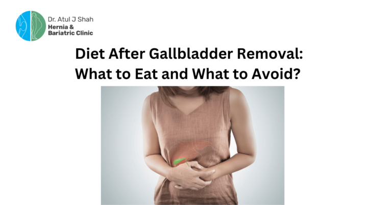 Diet After Gallbladder Removal: What to Eat and What to Avoid