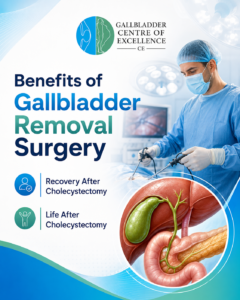 Gallbladder Removal