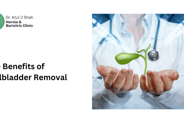 Gallbladder Removal