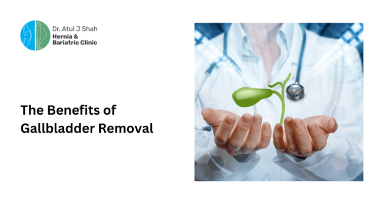 Gallbladder Removal