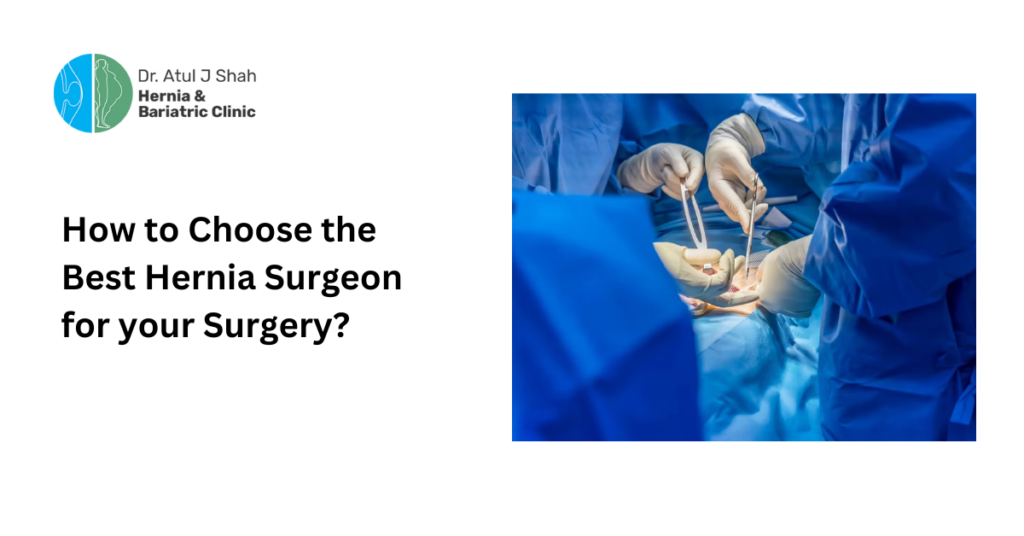 How to Choose the Best Hernia Surgeon for your Surgery