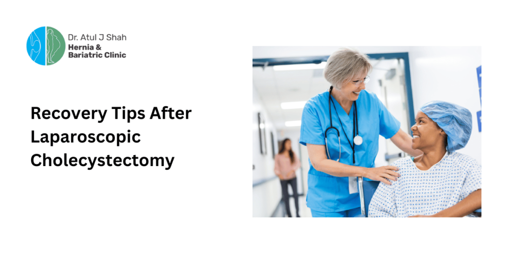 Recovery Tips After Laparoscopic Cholecystectomy