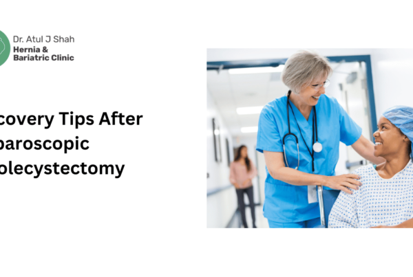Recovery Tips After Laparoscopic Cholecystectomy