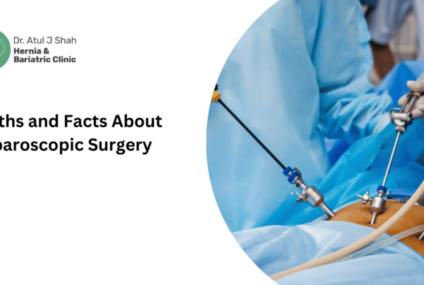 Myths and Facts About Laparoscopic Surgery