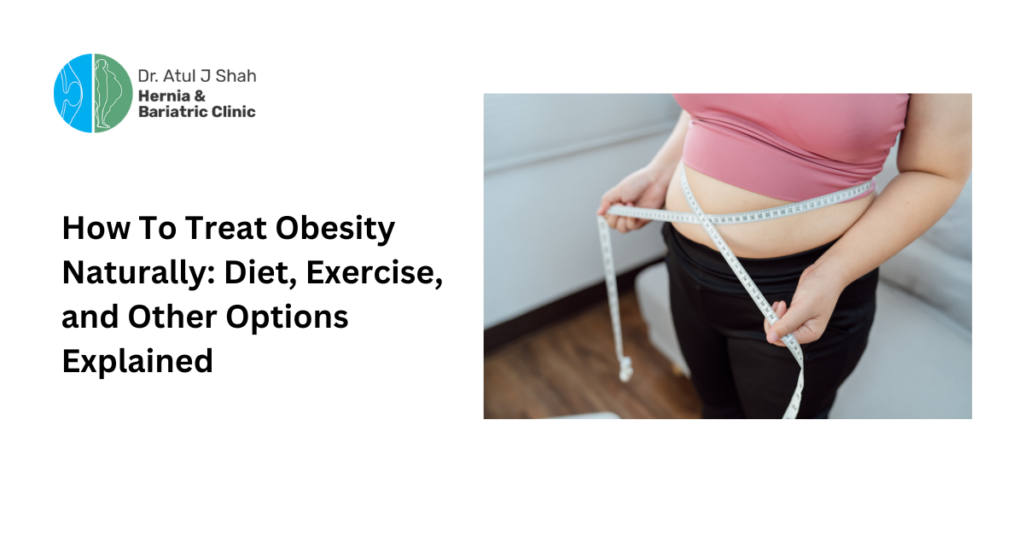 How to treat obesity naturally: Diet, exercise, and other options explained