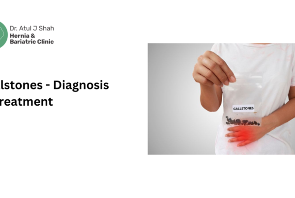 Gallstones - Diagnosis & Treatment