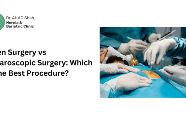 Open Surgery vs Laparoscopic Surgery: Which Is the Best Procedure?