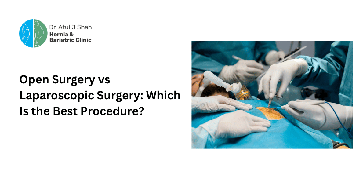 Open Surgery vs Laparoscopic Surgery: Which Is the Best Procedure?