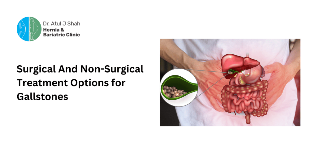 Surgical And Non-Surgical Treatment Options for Gallstones