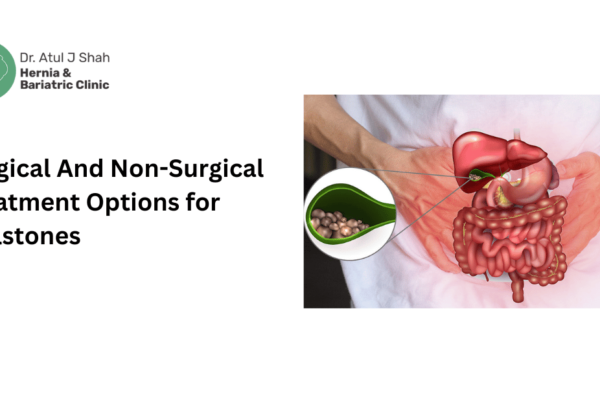Surgical And Non-Surgical Treatment Options for Gallstones