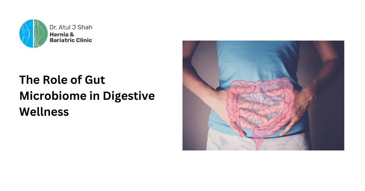 The Role of Gut Microbiome in Digestive Wellness