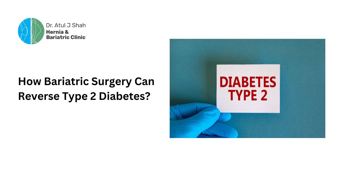How Bariatric Surgery Can Reverse Type 2 Diabetes?