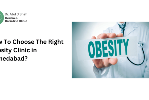 How To Choose The Right Obesity Clinic in Ahmedabad?