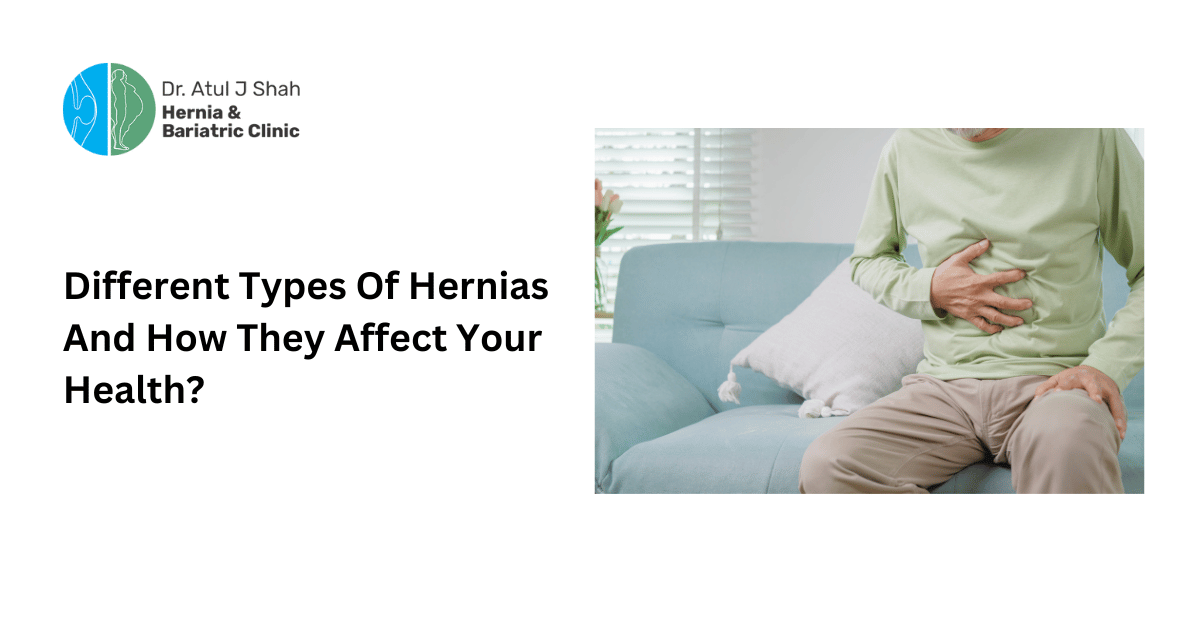 Different Types Of Hernias And How They Affect Your Health?