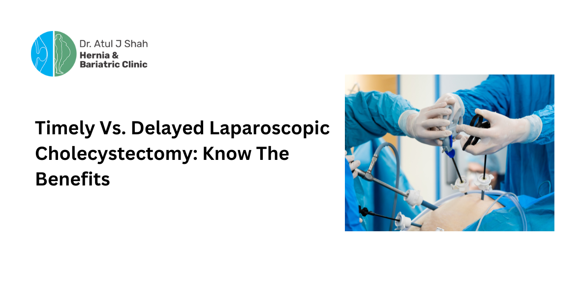 Timely Vs. Delayed Laparoscopic Cholecystectomy Know The Benefits