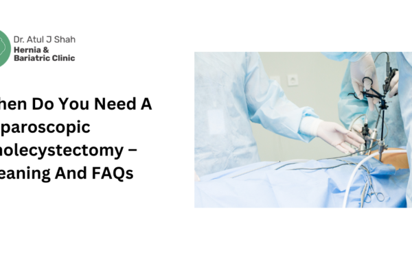 laparoscopic cholecystectomy surgery